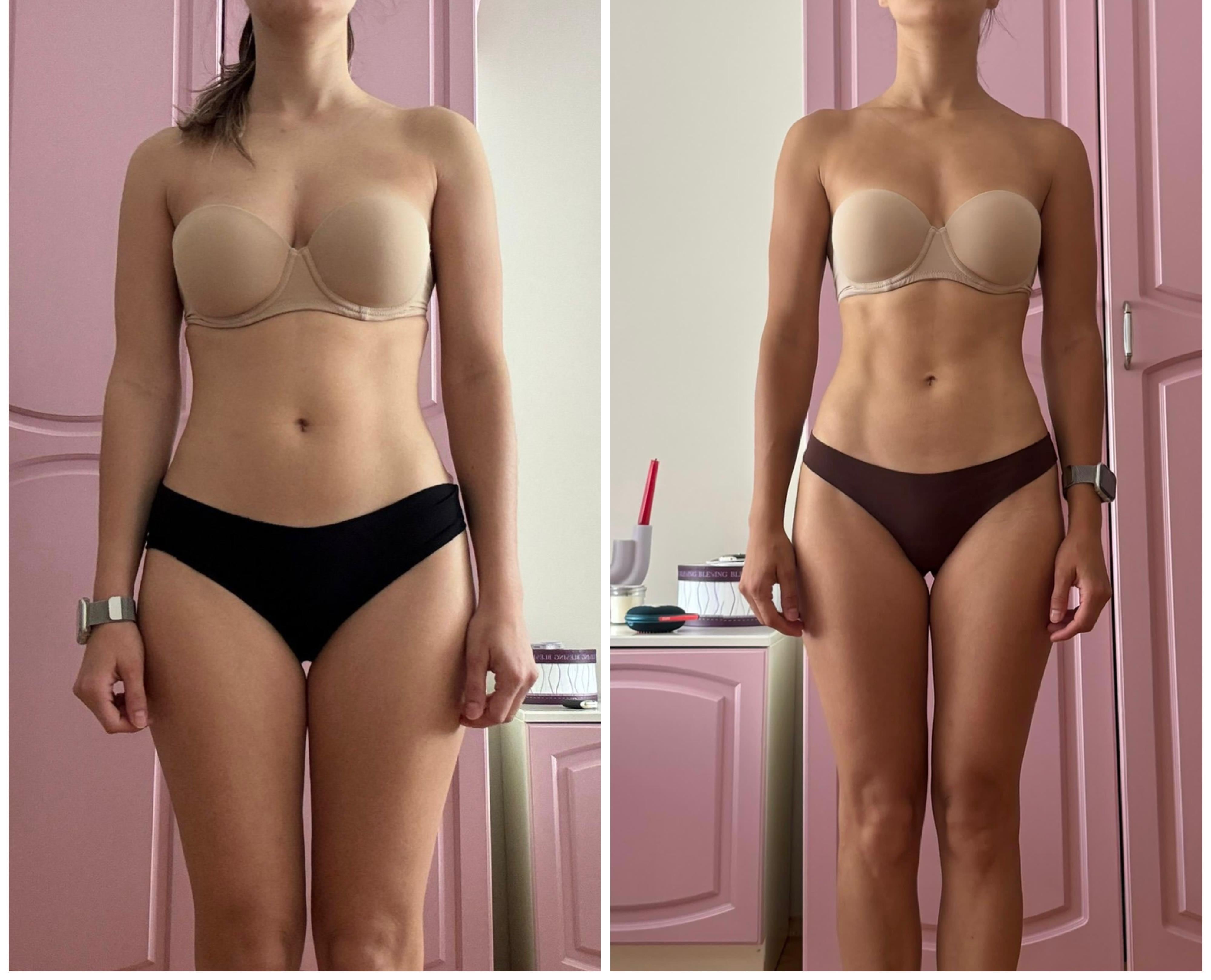 Tuğçe S. önce ve sonra değişim fotoğrafı
